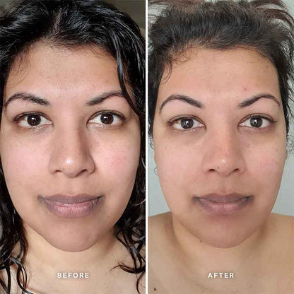 Alpha-H Vitamin C Serum with 10% Ethyl Ascorbic Acid | 25ml vitamin c face repair serum before and after using for 8 weeks | 8 week trial using alpha-h vitamin c serum