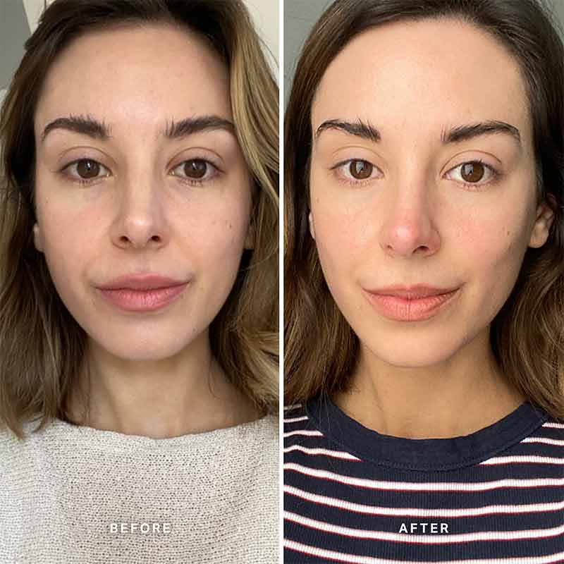 Alpha-H Vitamin C Serum with 10% Ethyl Ascorbic Acid | 25ml vitamin c face repair serum | 8 week trial using vitamin c serum