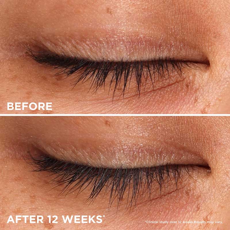 Benefit | Whoop Lash | gentle | conditioning | lash-enhancing serum | fuller | thicker | longer | clinically tested |  transform | healthier | nourished