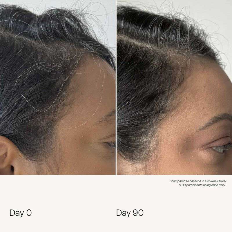 Living Proof Scalp Care Density Serum | Lightweight scalp serum | Clinically proven results | 90 days