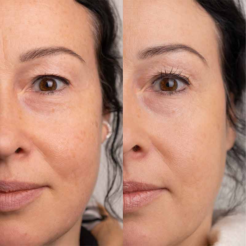 SWEED Pro Lash Growth Serum before and after  trial using vitamins for lashes