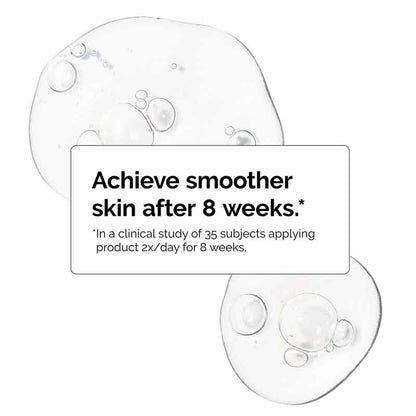 The Ordinary Niacinamide 10% + Zinc 1% - smoother skin